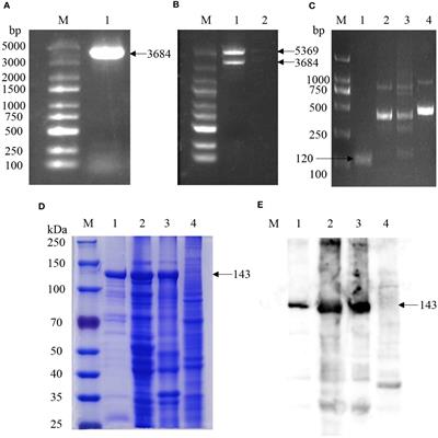 KP177R-based visual assay integrating RPA and CRISPR/Cas12a for the detection of African swine fever virus